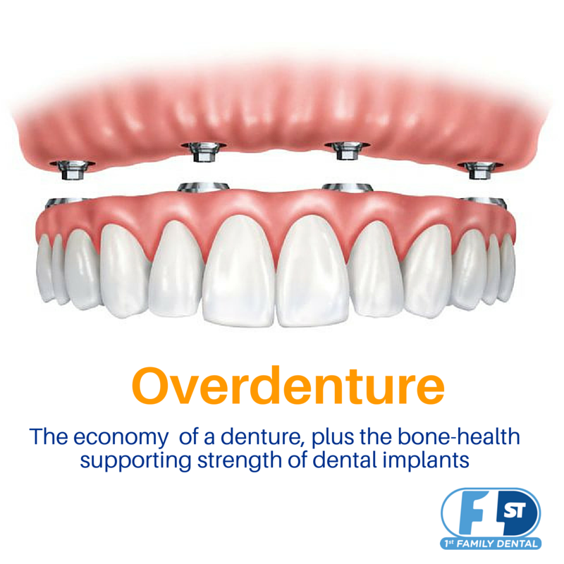 10+ Affordable Options For No Insurance Tooth Removal