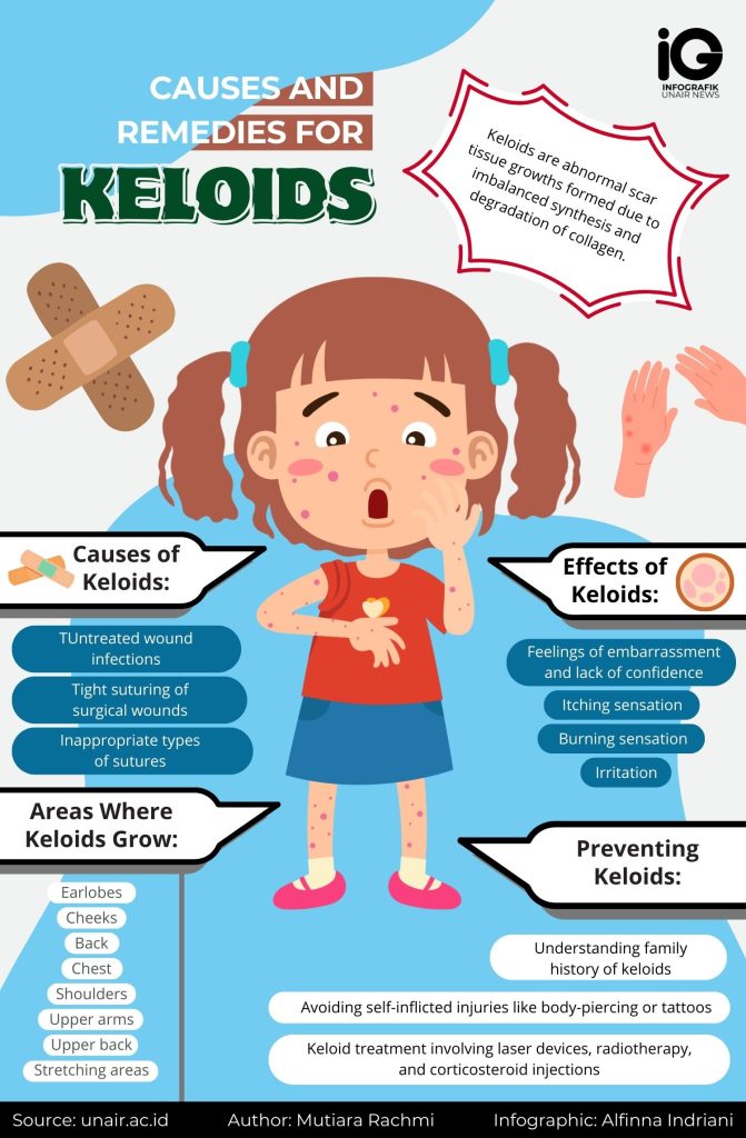 10 Aspirin Paste Remedies To Shrink Keloids 10 Aspirin Paste Remedies To Shrink Keloids