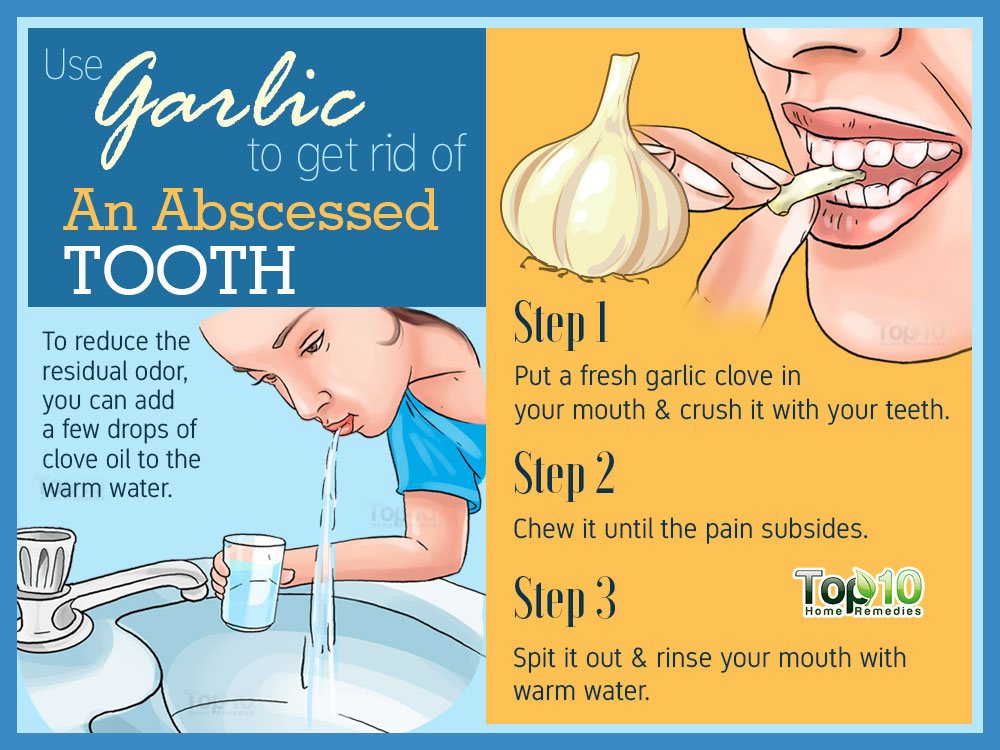 10+ Blue Colored Tooth Remedies To Try Tonight