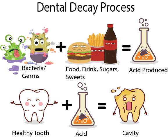 10 Carbonated Water Facts To Prevent Cavities