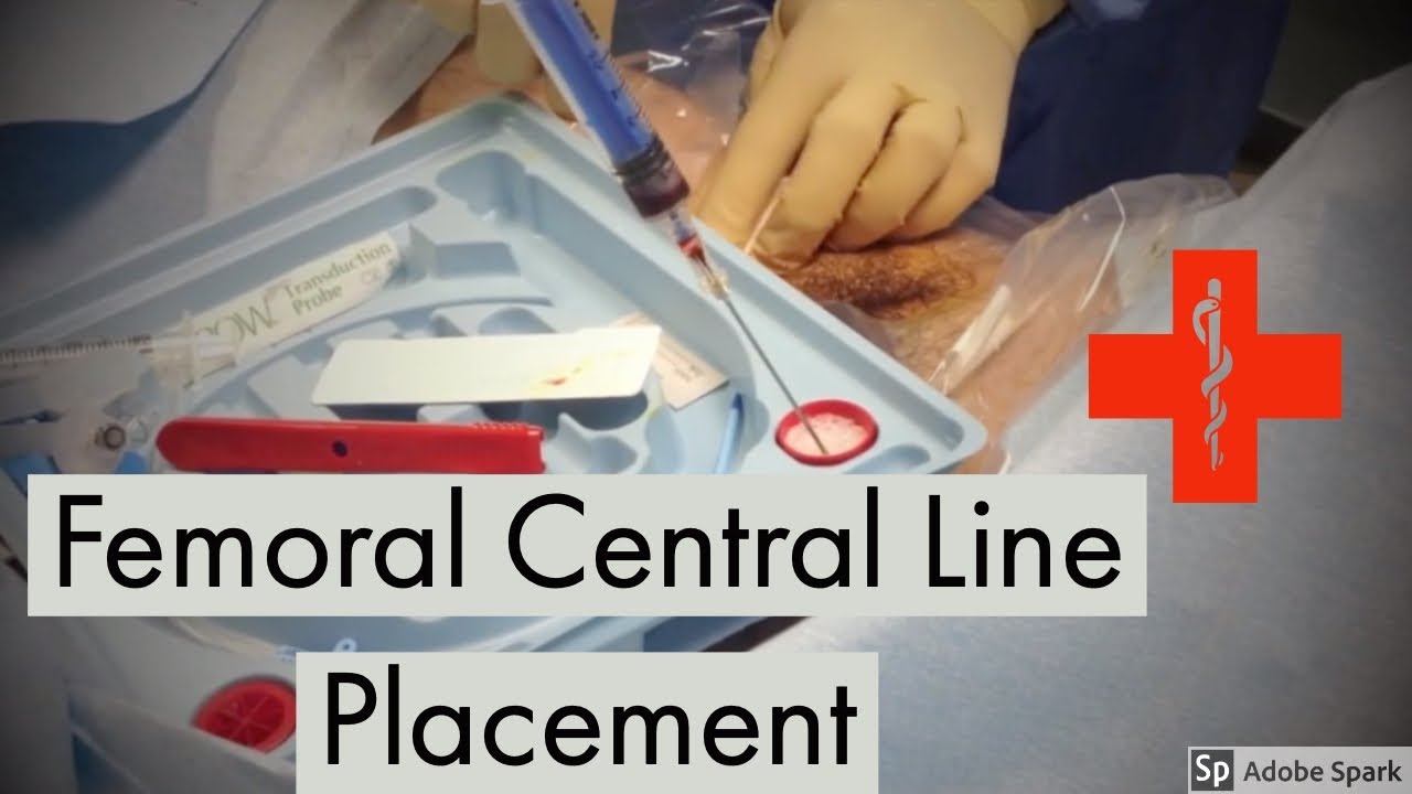 10 Central Line Femoral Tips For Easier Placement