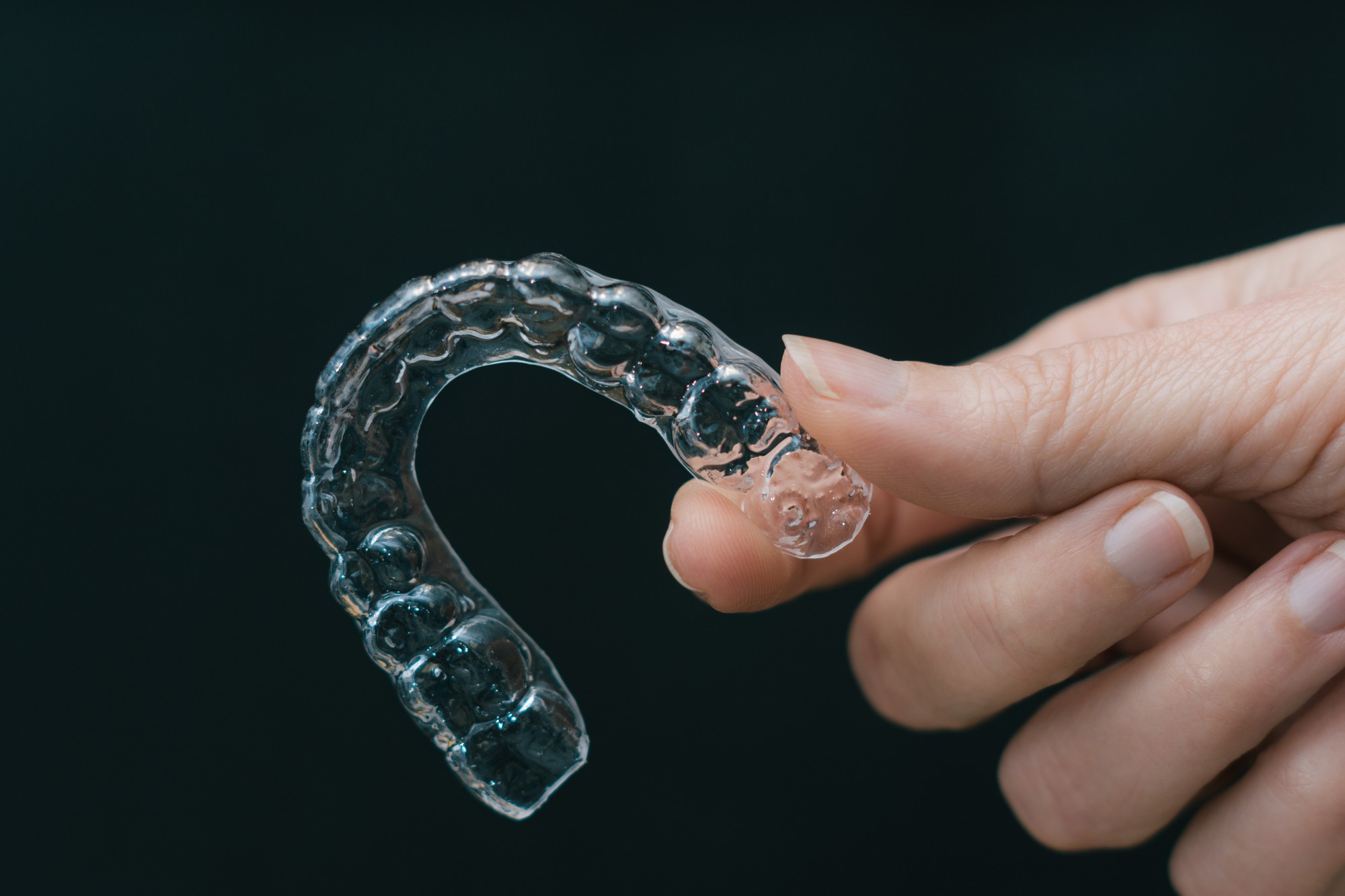 10+ Clear Aligners Secrets For Fast Results 10+ Clear Aligners Secrets For Fast Results