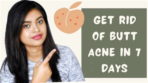 10 Dark Butt Crack Remedies That Work