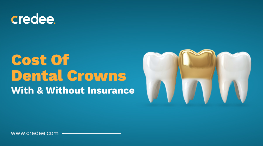 10 Dental Crowns Cost Canada Savings Tips