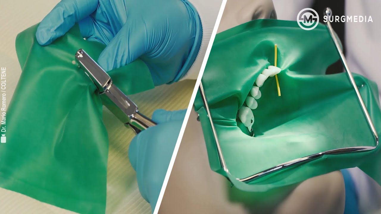 10 Dental Rubber Dam Tips For Easy Placement