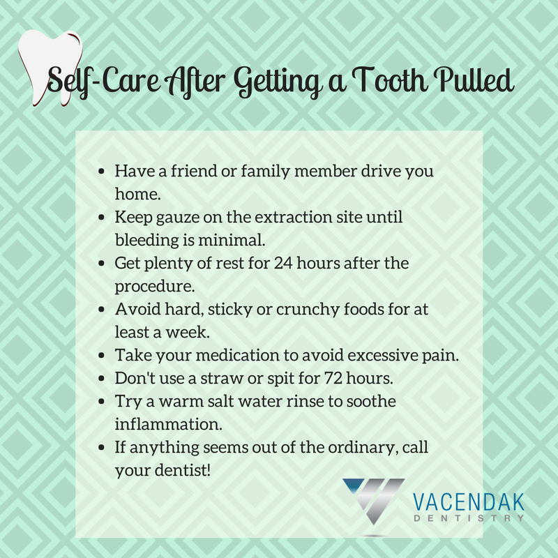 10+ Get Tooth Pulled Options To Save Time