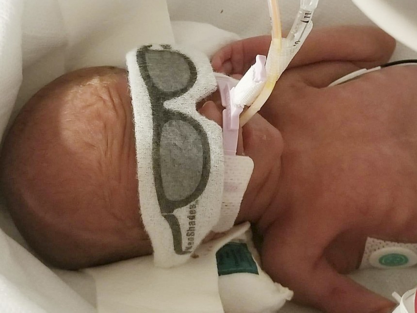 10 Neonatal Et Tube Sizes For Easy Insertion