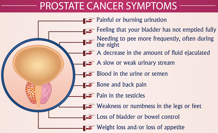 10 Prostate Cancer Month Colors You Should Know