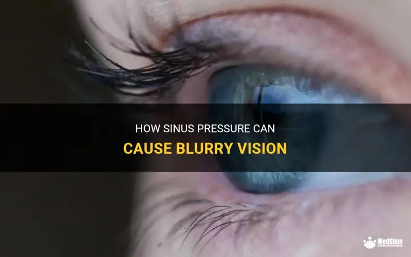 10+ Sinus Pressure Tips To Clear Your Head Fast 10+ Sinus Pressure Tips To Clear Your Head Fast