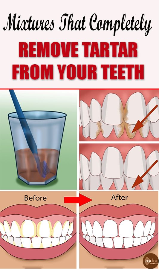 10 Teeth Feel Rough Fixes For Smoother Smile