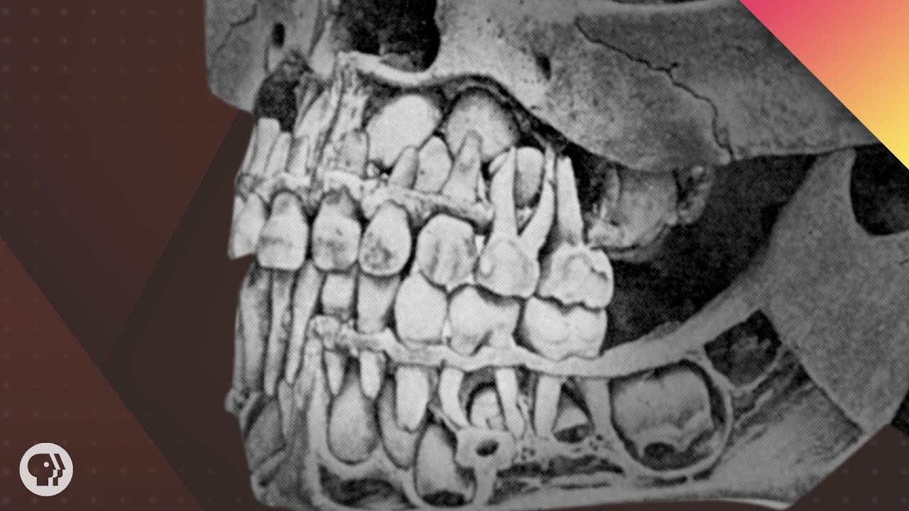 10 Teeth X Ray Prices You Need To Know 10 Teeth X Ray Prices You Need To Know