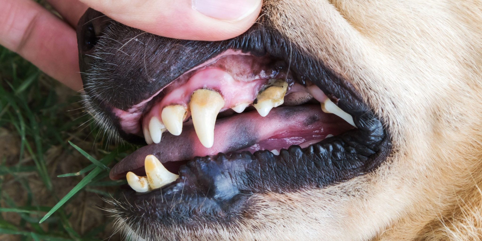 10 Toothpaste Tartar Removers For Healthier Smiles