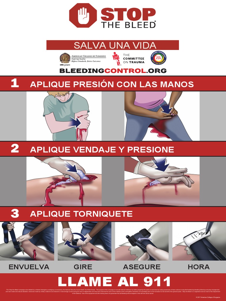 10+ Trucos Para Detener El Sangrado De Nariz Con Coagulos Rápidamente