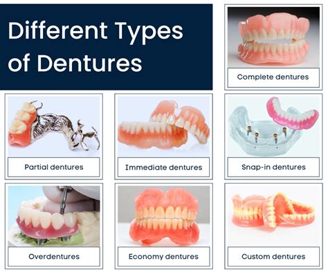 10 Upper Partial Dentures Types For Easy Smiling