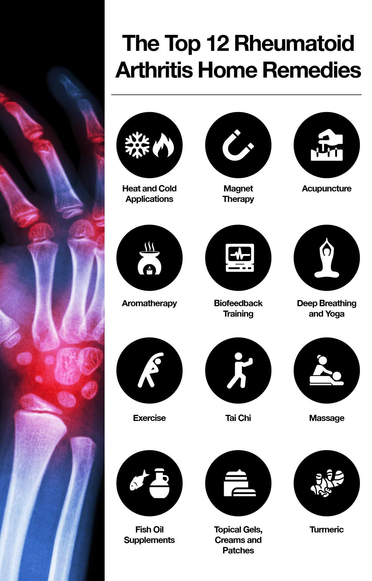 12 Arthritis Remedies To Reduce Cold Pain