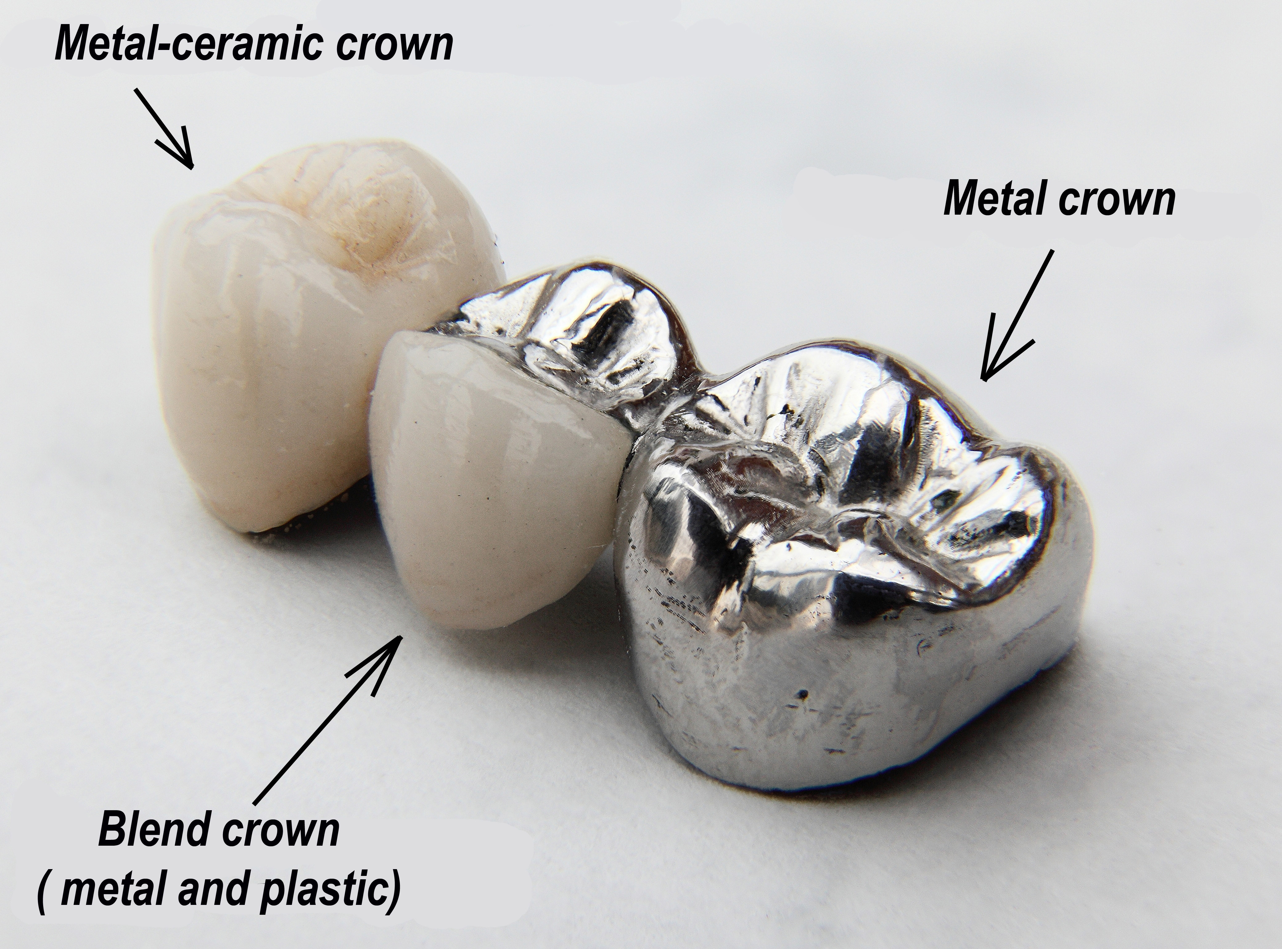 12 Bridge Crown Teeth Tips For Perfect Smile