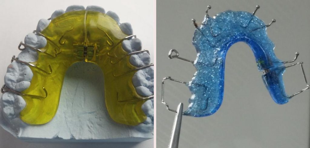 12+ Broken Retainer Wire Solutions