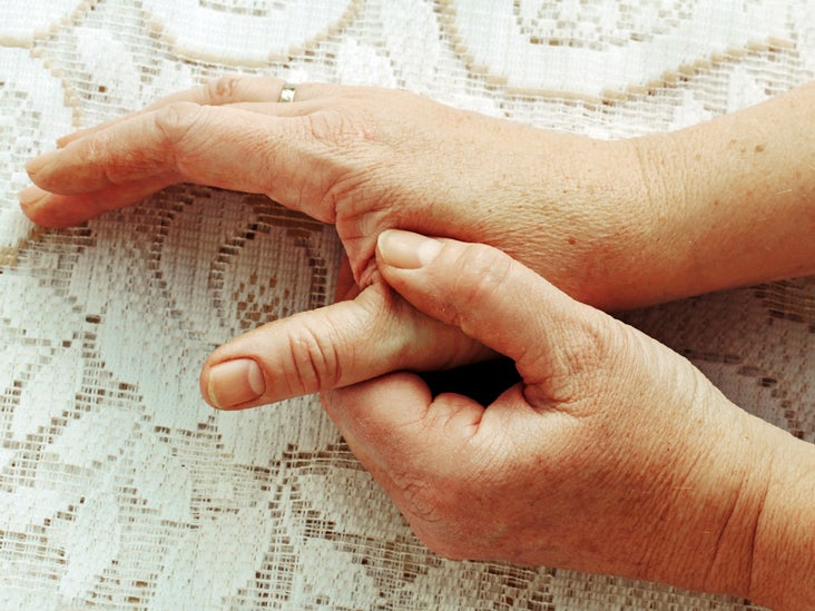 12+ Dislocated Thumb Remedies For Less Pain