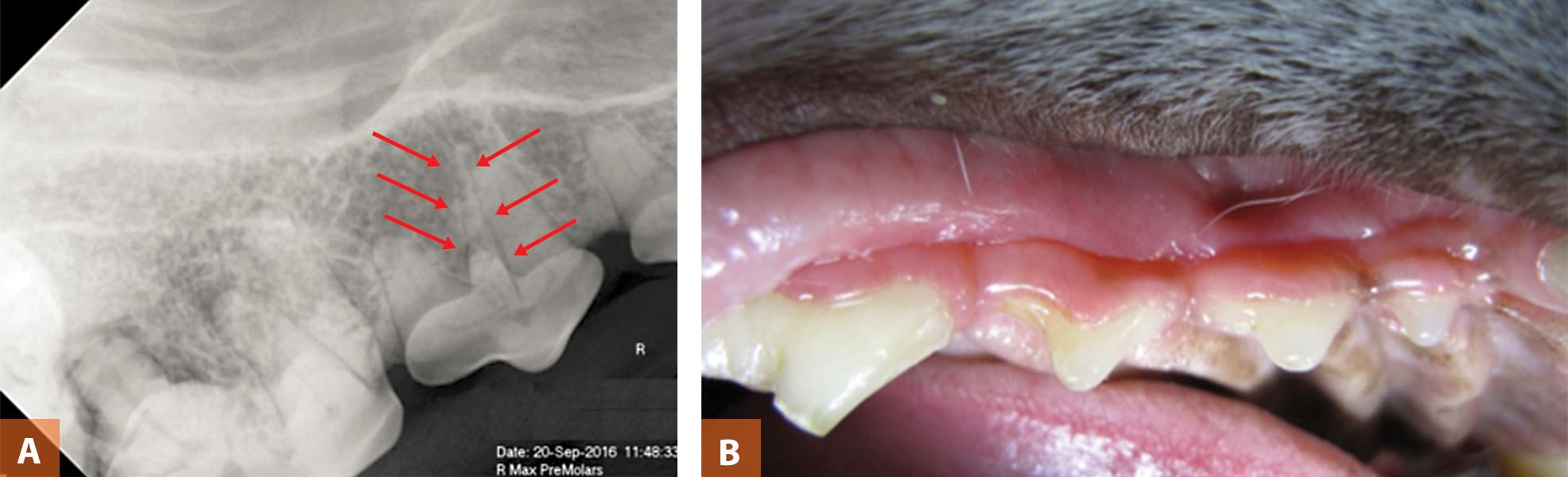 12+ Extraction Secrets To Avoid Complications