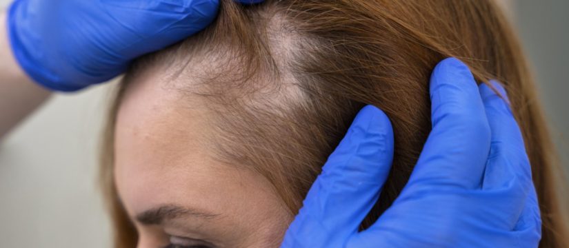 12 Feridinhas Na Cabeça Que Coçam Remedios