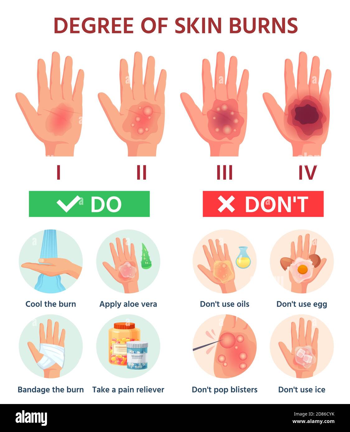 12+ First Degree Burn Pictures For Faster Healing