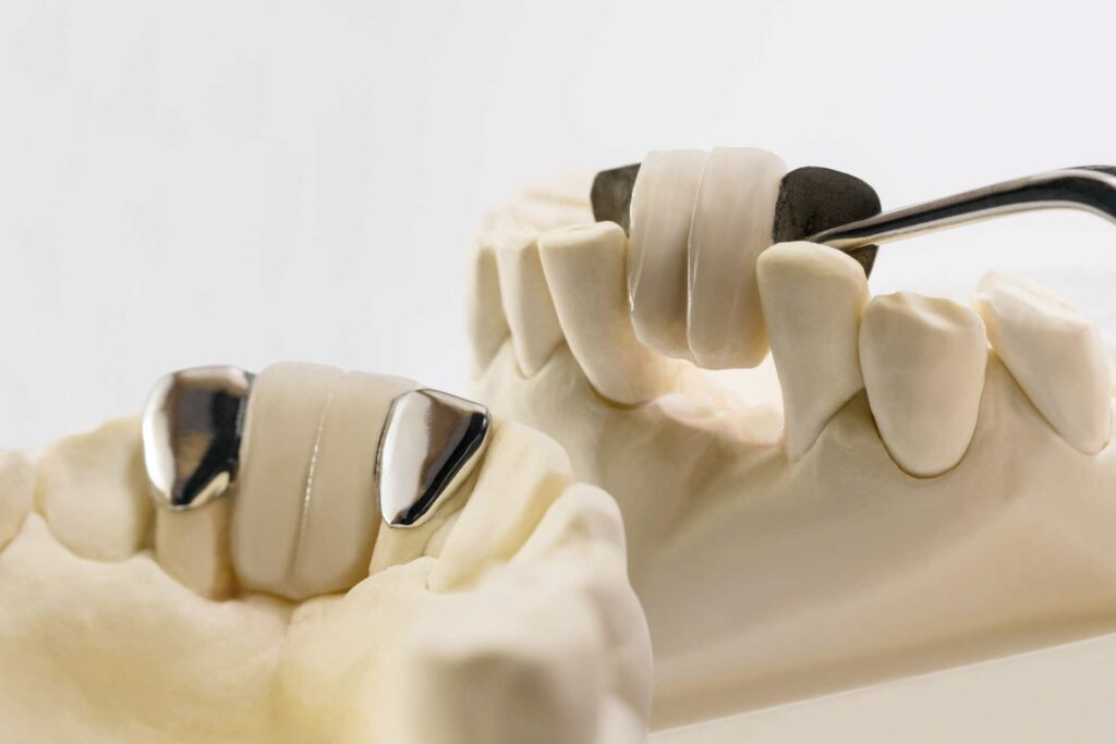 12 Marilyn Bridge Dental Tips For Perfect Smile