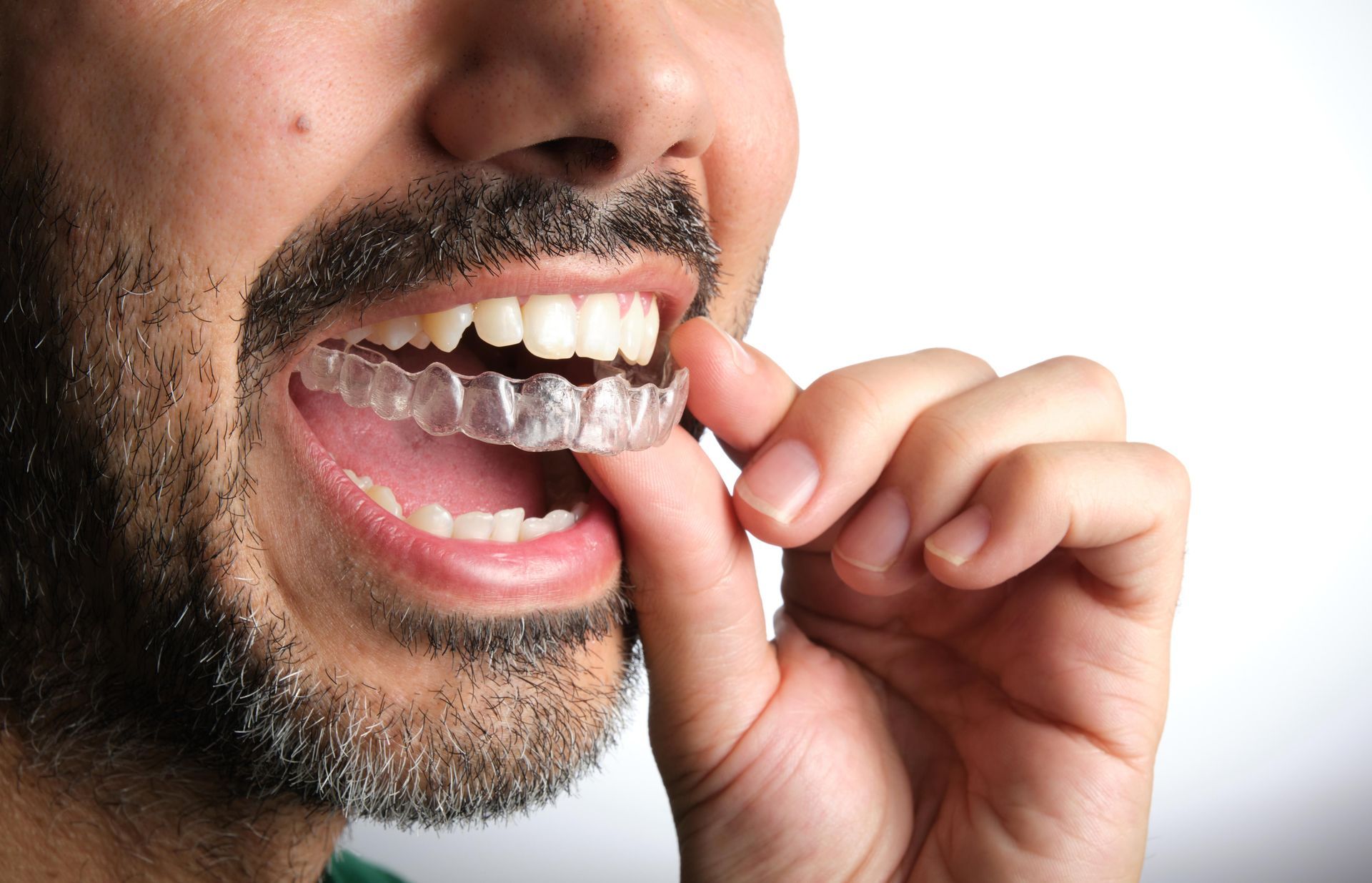 12+ Parkersburg Secrets For Affordable Smiles