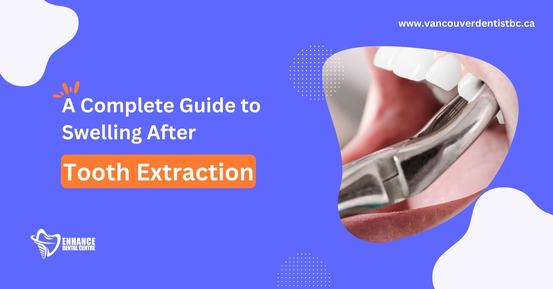 12+ Tooth Extraction Tea Bag Tips To Reduce Swelling