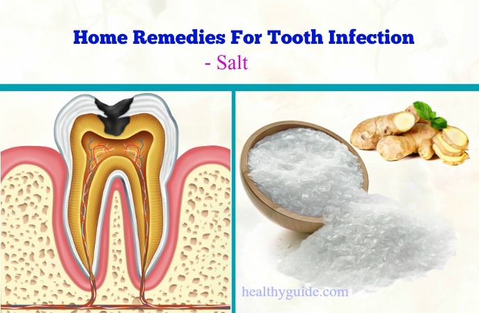 12+ Tooth Infection Remedies For Relief