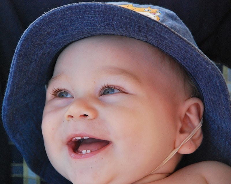 12+ X Ray Tips For Baby Teeth Development