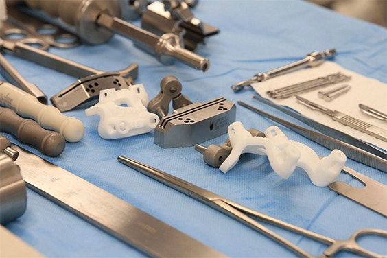 3D Knee Model: Personalized Surgery Planning 3D Knee Model: Personalized Surgery Planning