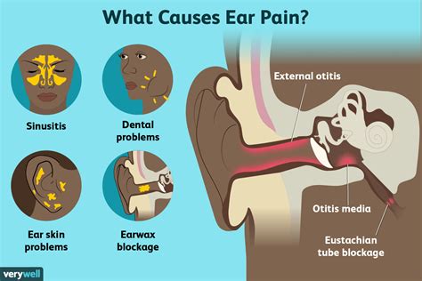 7 Ear Pain Causes From Toothaches Explained 7 Ear Pain Causes From Toothaches Explained