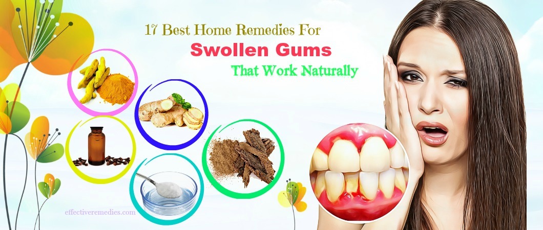 8 Small Cuts On Gums Remedies For Fast Healing