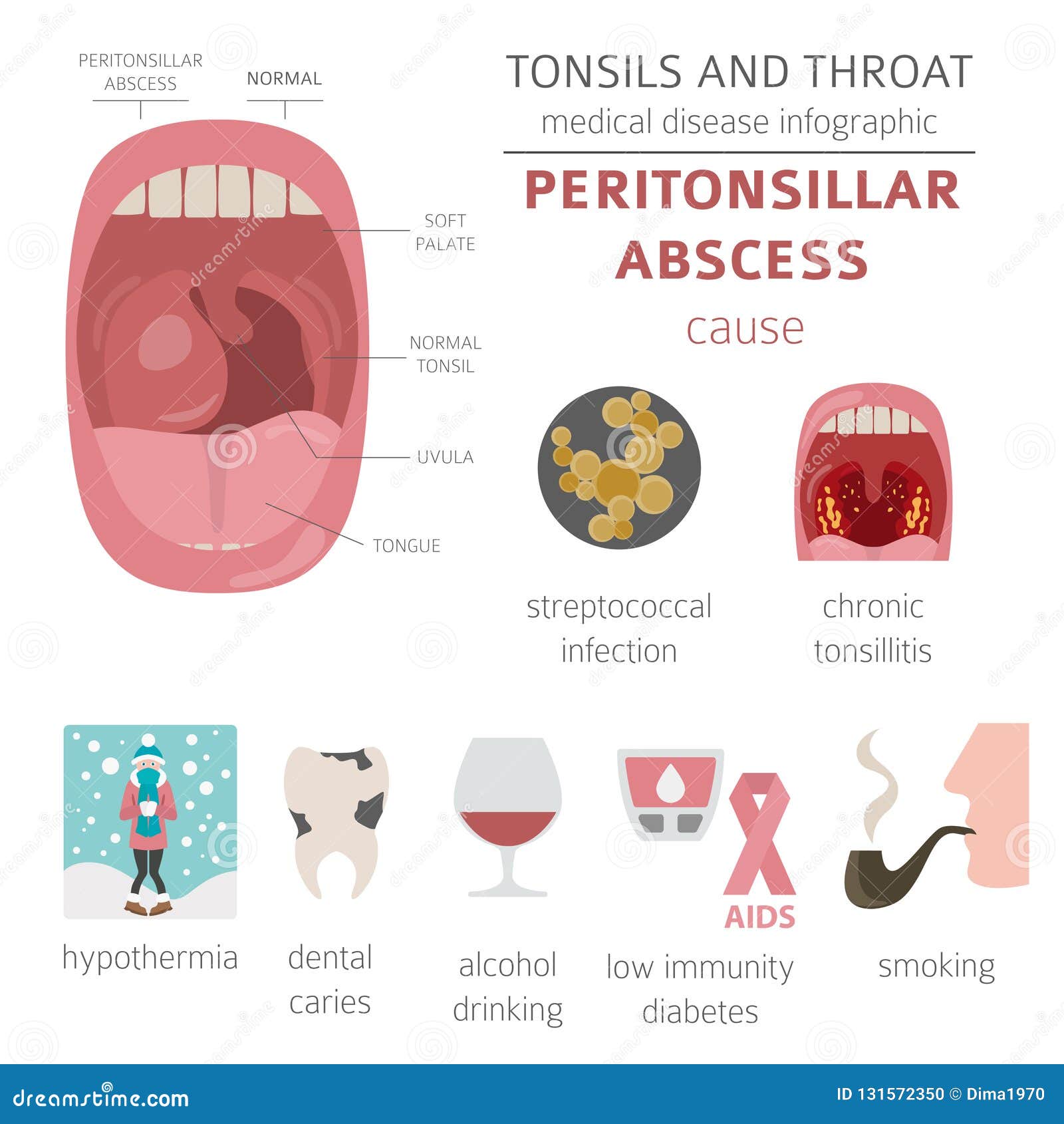 8+ Tonsil Abscess Images To Identify Symptoms Fast