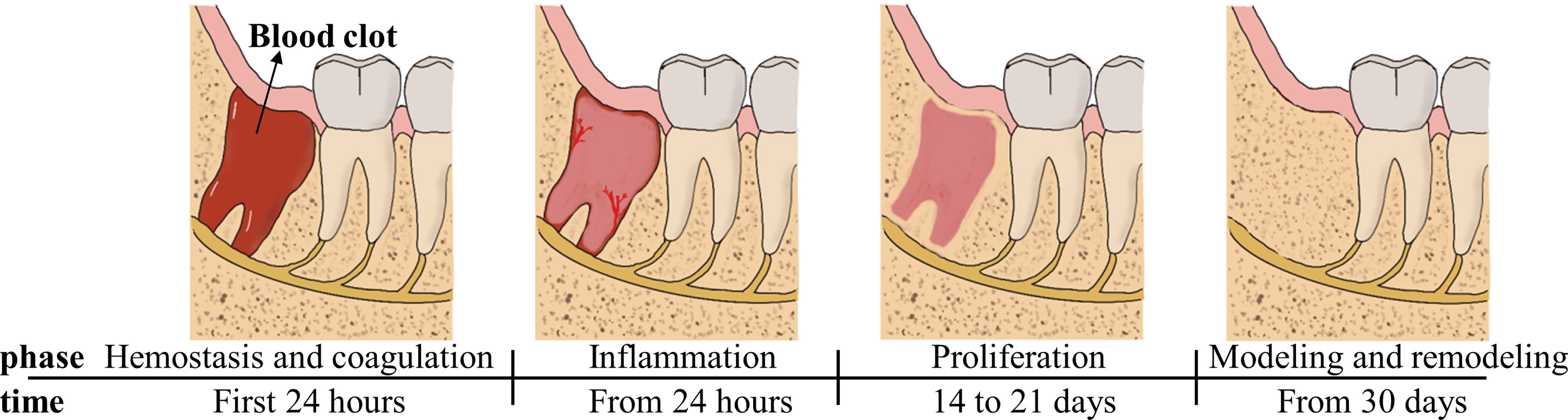 Abscessed Tooth After Extraction: Healing Guide