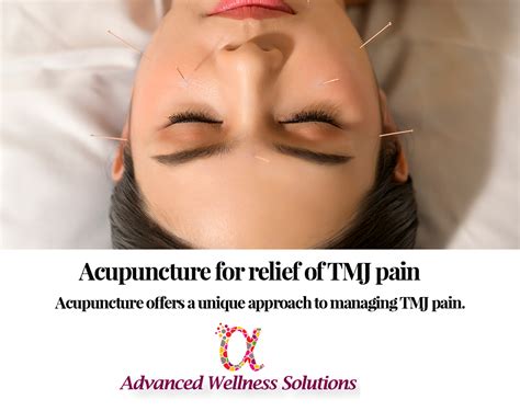 Acupuncture For Tmj: Natural Relief Found