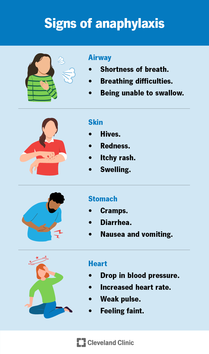 Allergic To Pepper: Diagnosis And Treatment Guide