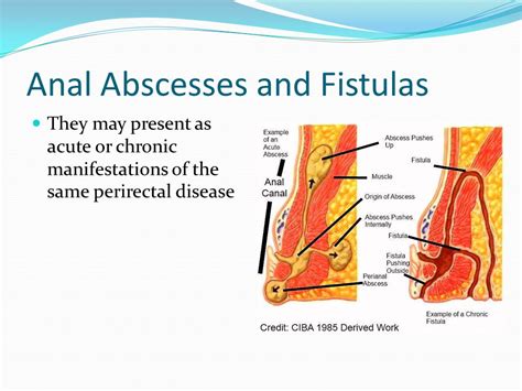 Anal Abscess Recovery: Reduce Pain & Complications