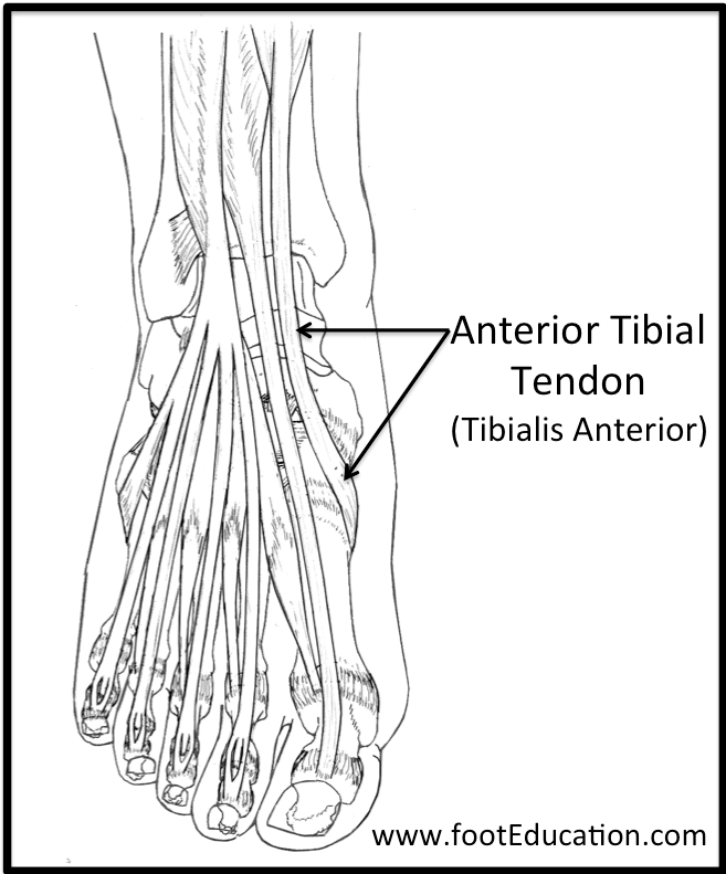 Anterior Tibial Tendonitis: Strengthen Ankles Fast