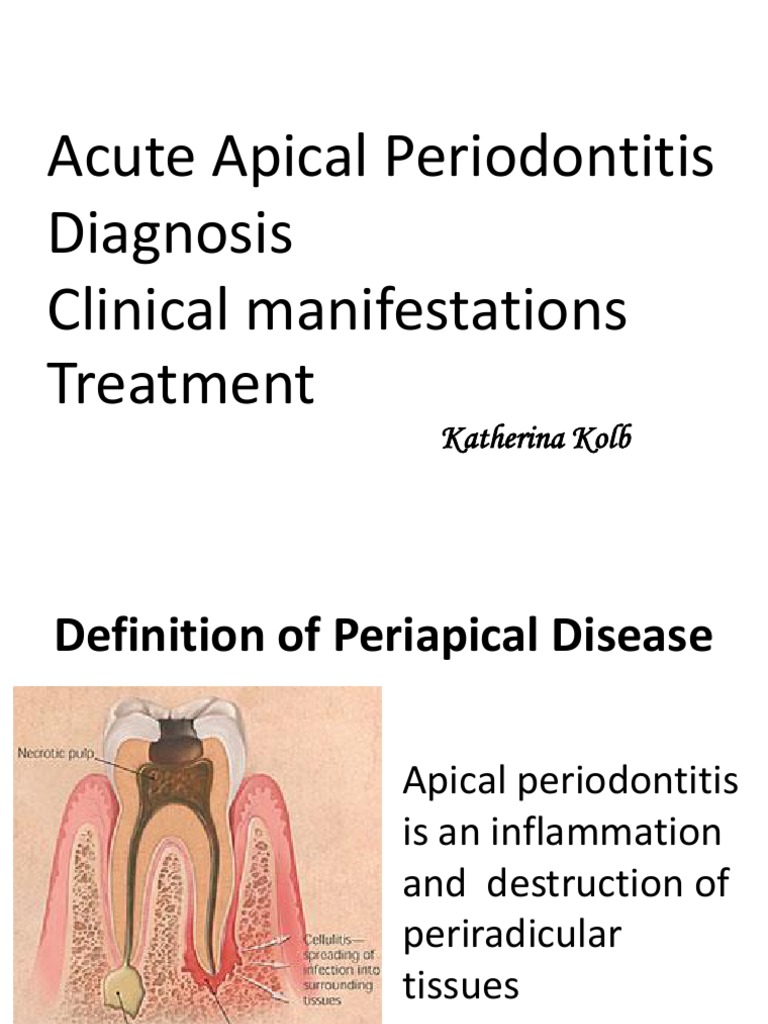 Apical Periodontitis Guide: Diagnosis To Treatment