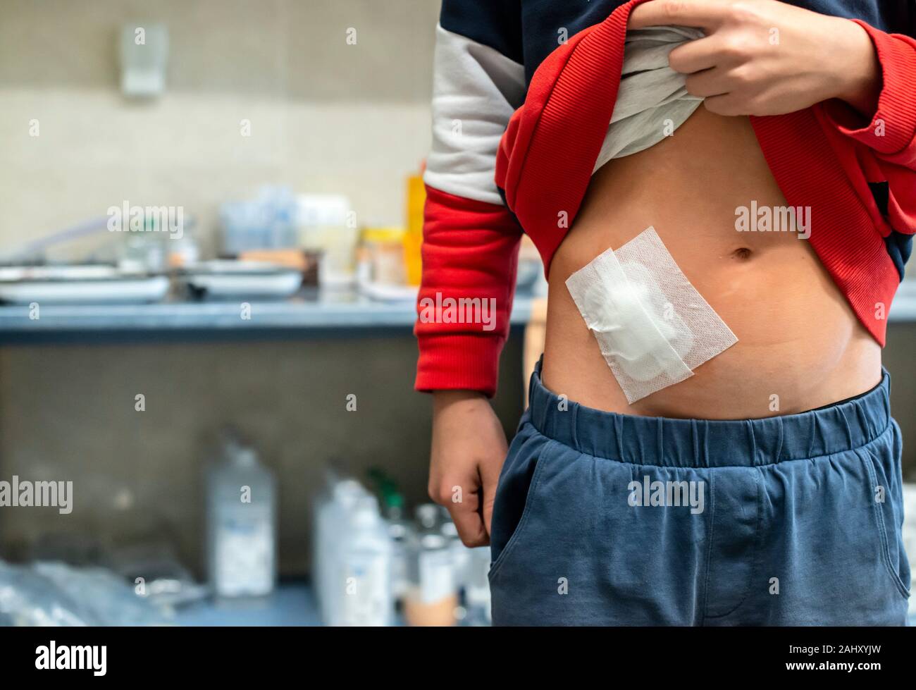 Appendix Scar Belly Button