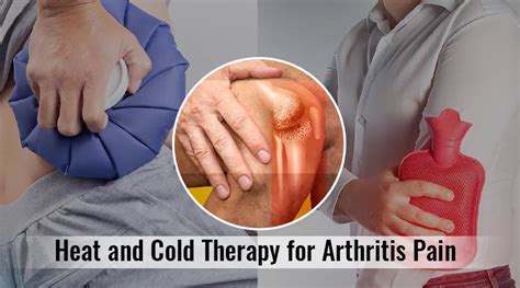 Arthritis And Cold