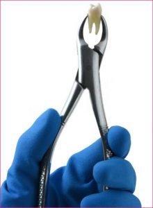 Aspen Dental Hulen: Experts In Gentle Tooth Extractions