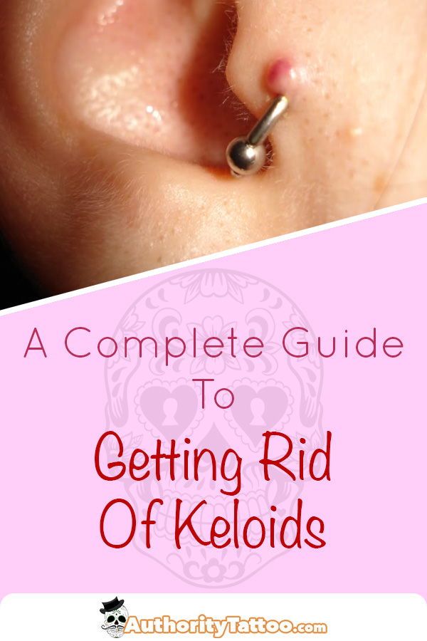 Aspirin Paste For Keloids