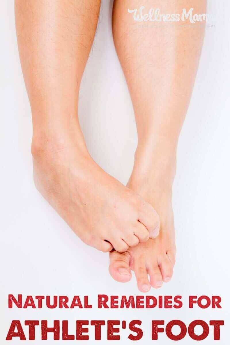 Athlete's Foot Relief: Natural Remedies