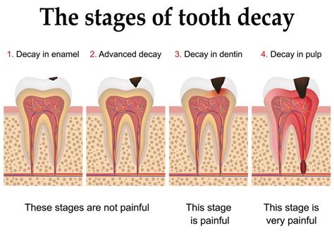 Back Of Teeth Feel Rough