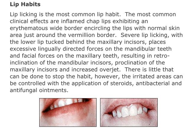 Bad Lip Habits Stopped: Break Free