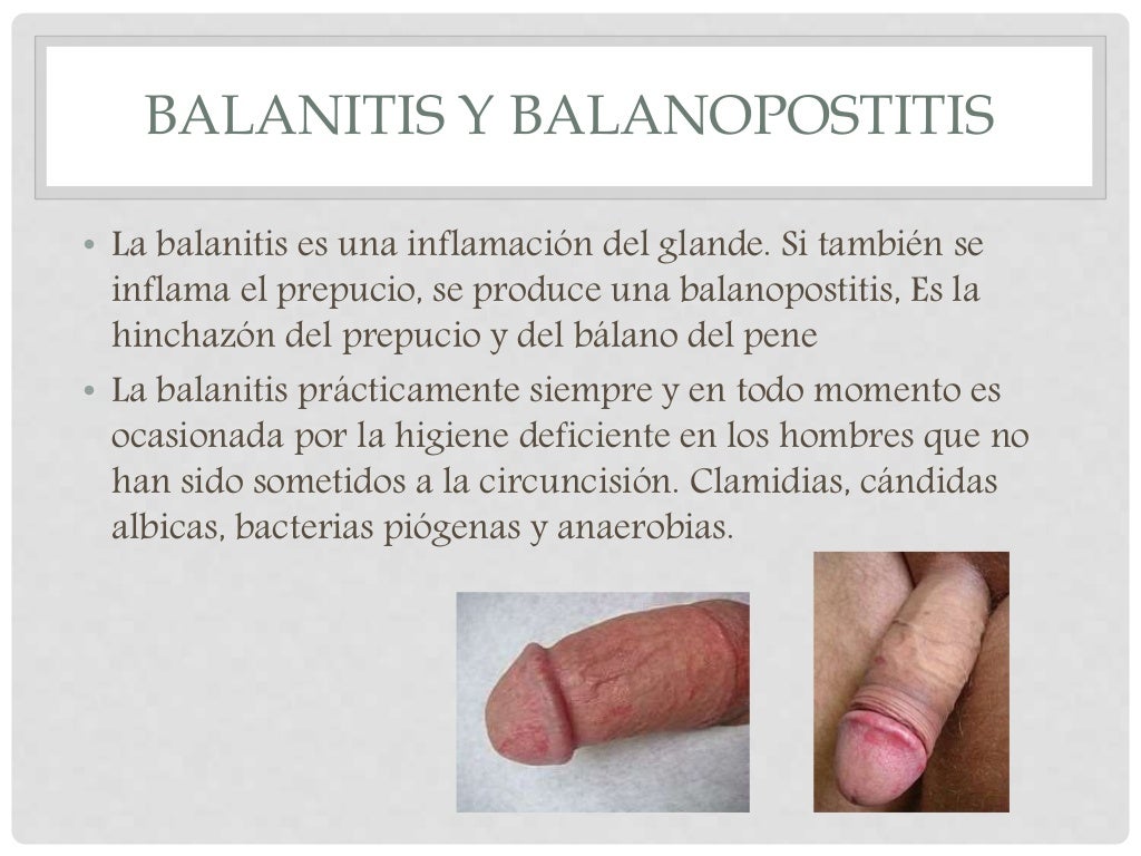 Barros En El Pene