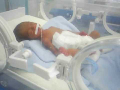 Bebê De 24 Semanas