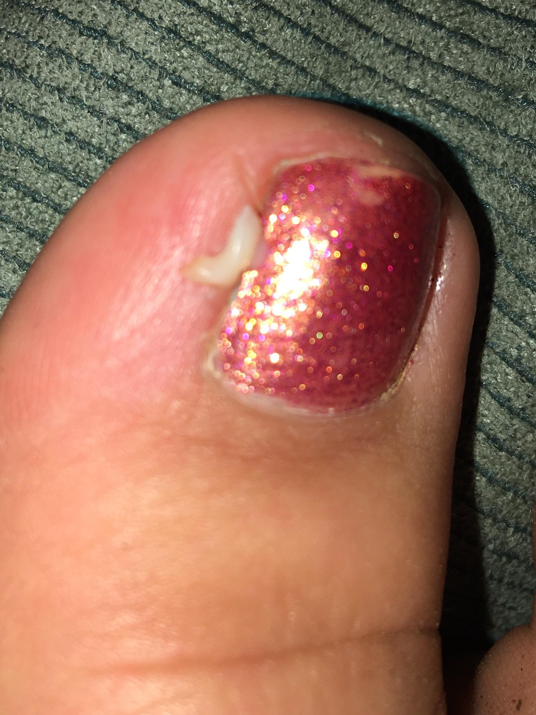 Big Toe Popping